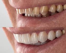 سالن انتظار